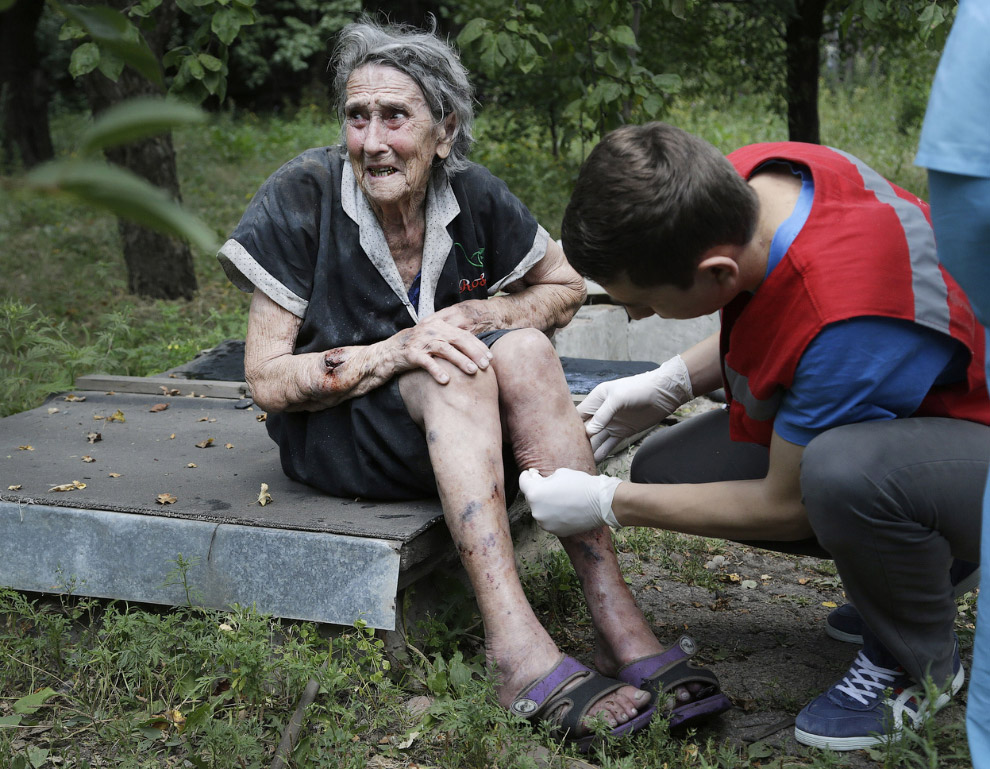 Раненая после обстрела Донецка