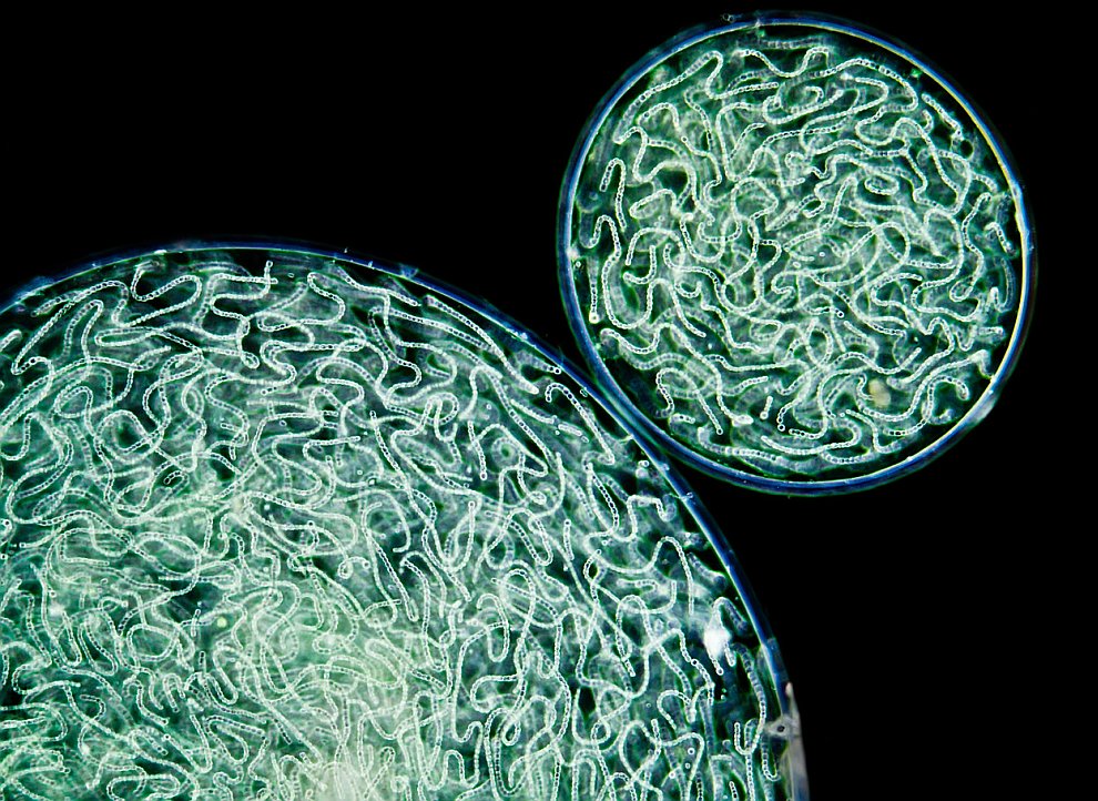 Колония цианобактерий