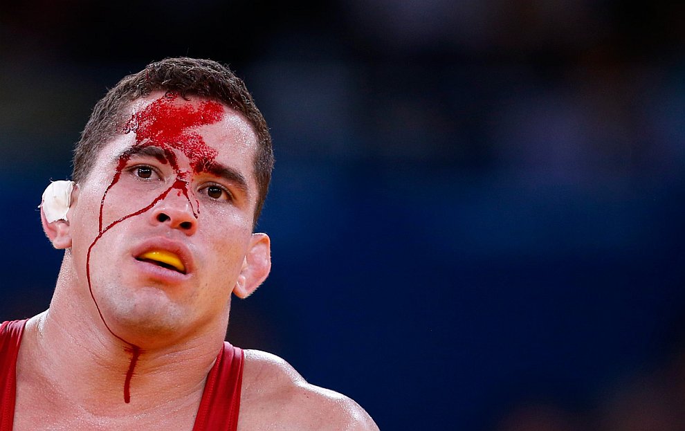 Венесуэлец Рикардо Роберти Морено получил небольшую травму в соревнованиях по вольной борьбе в Олимпийском Лондоне