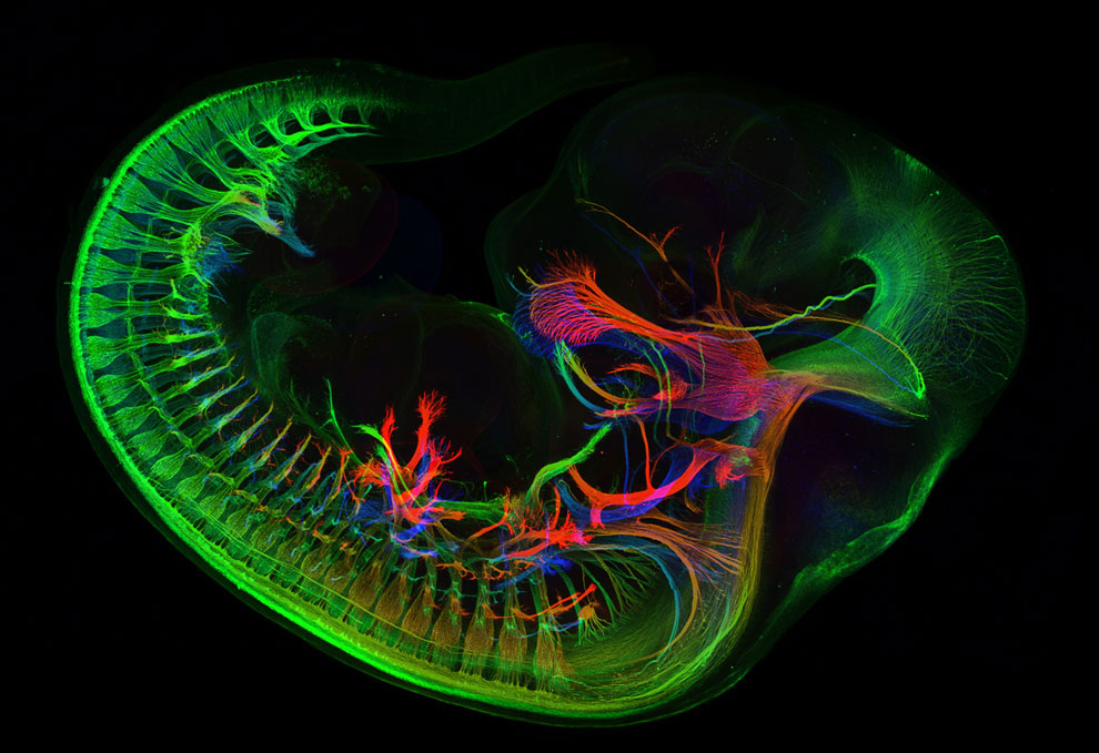 Нервы сферические у эмбриона мыши