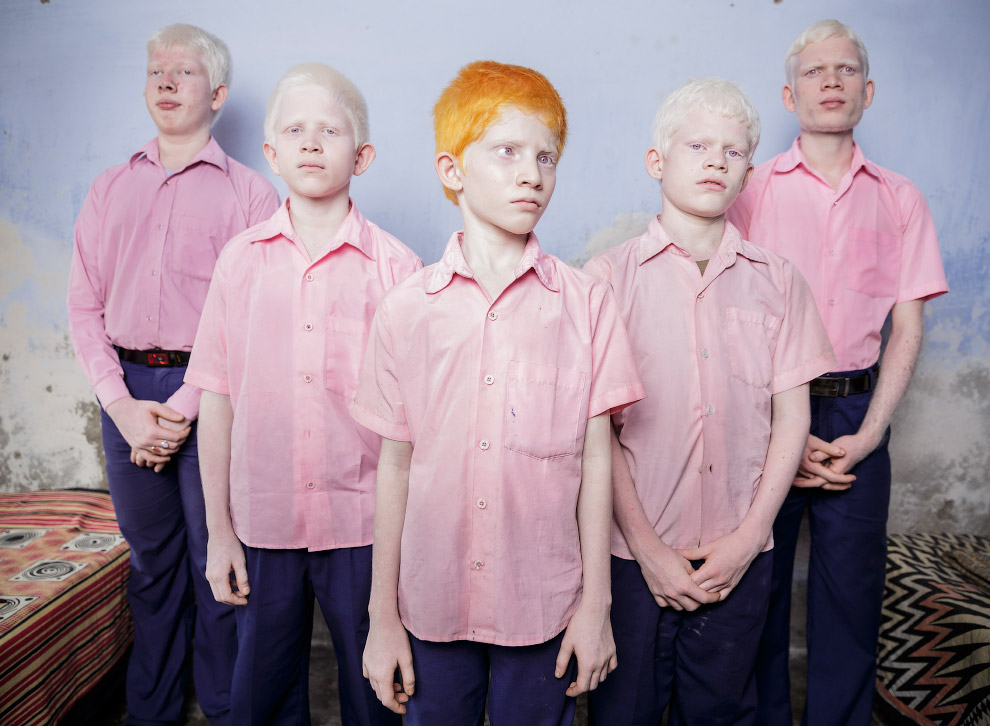 Групповой снимок слепых мальчиков-альбиносов в интернате в Западной Бенгалии