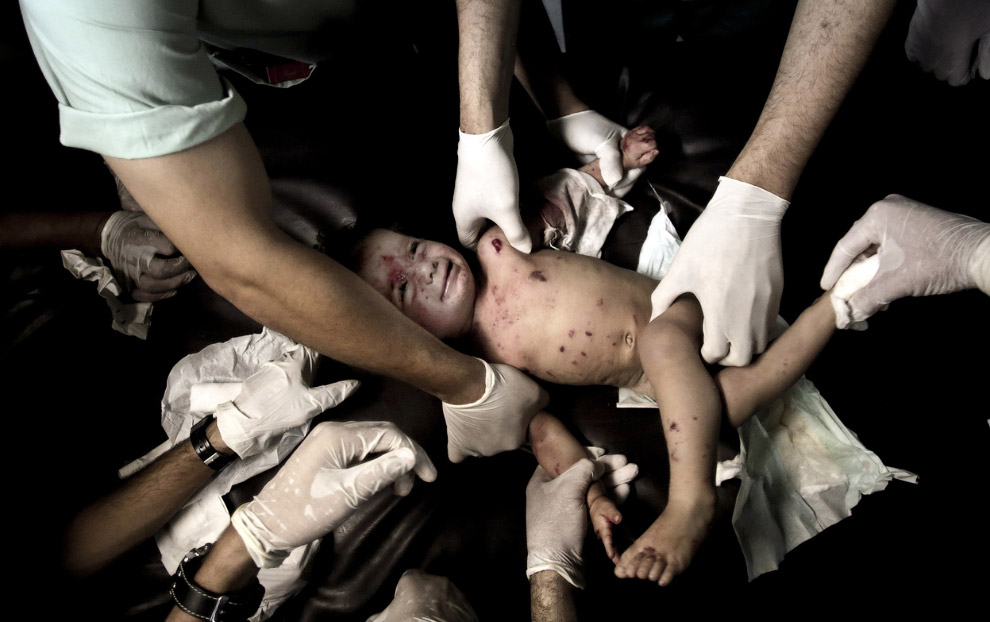 Раненая девочка,город Газа