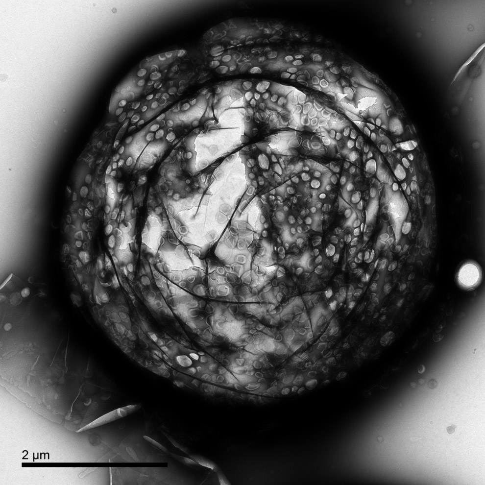 Микро-пузыри в электронном микроскопе